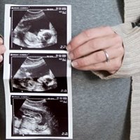 https://connect.bcbsmt.com/cfs-file/__key/communityserver-blogs-components-weblogfiles/00-00-00-00-17/PregnancyBabyUltrasound.jpg